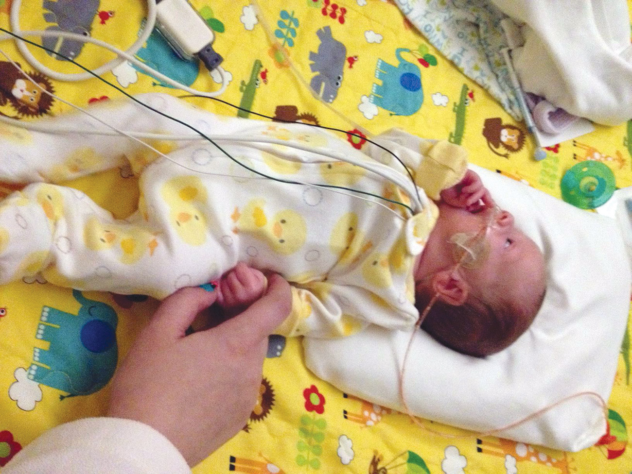 新生儿重症监护室的新生婴儿。